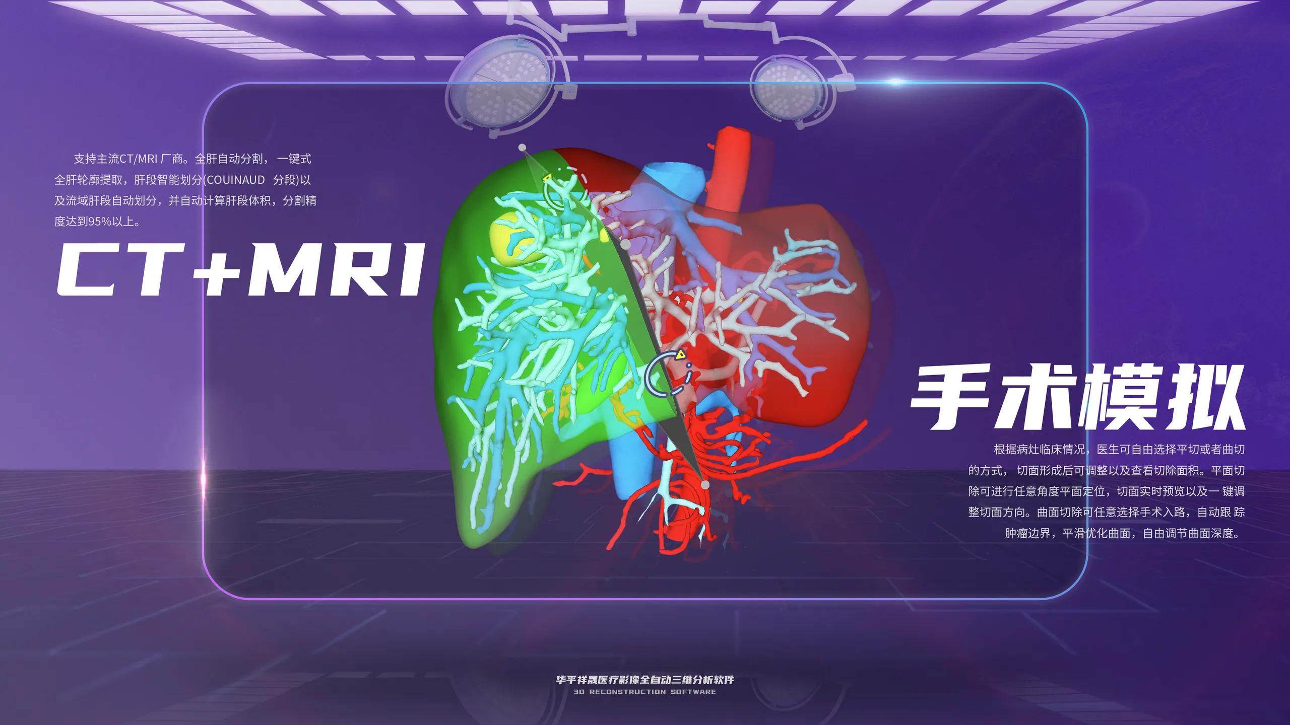 肝脏三维重建：CT+MRI 融合与手术模拟