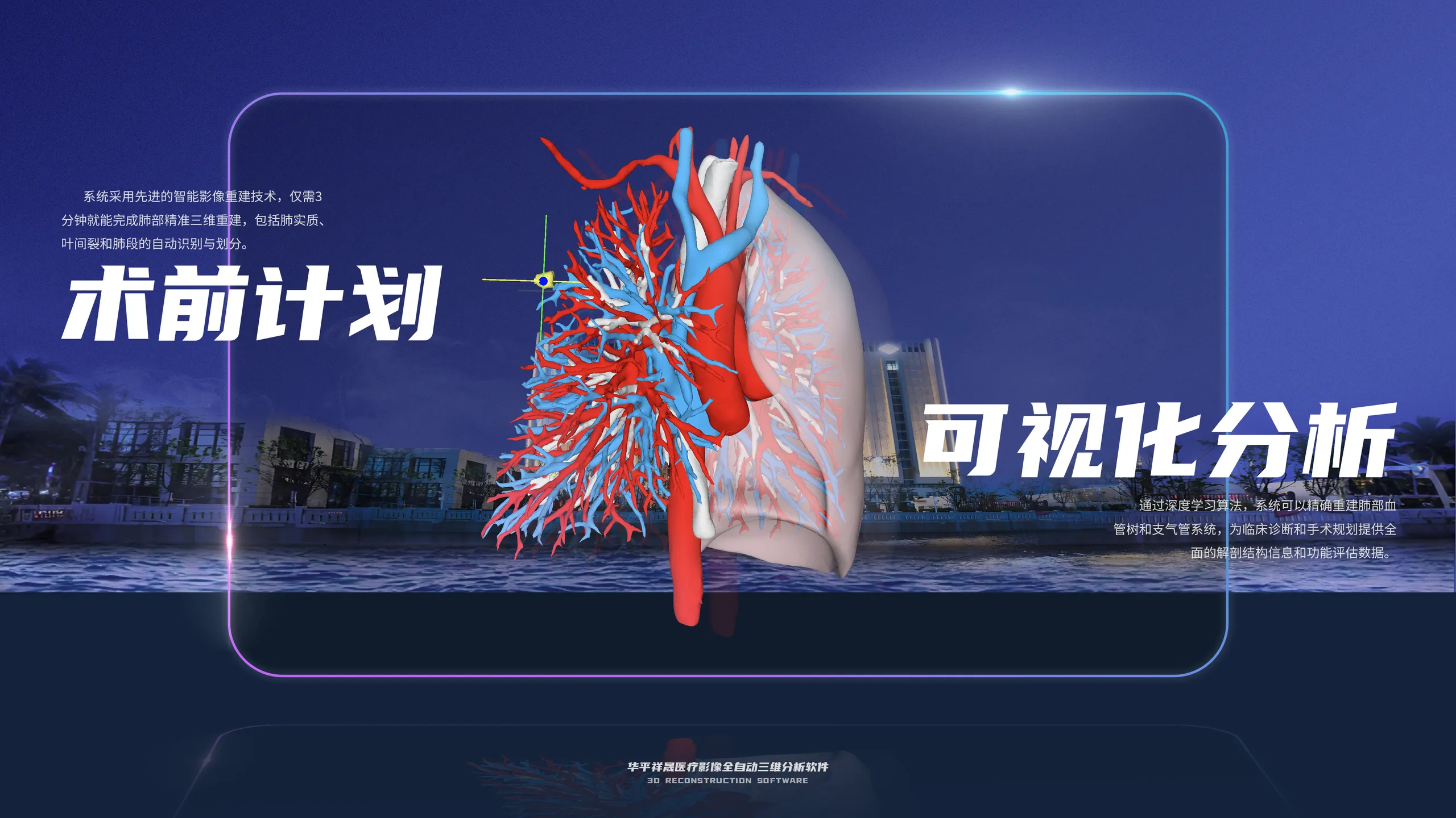 肺部三维重建：术前计划与可视化分析